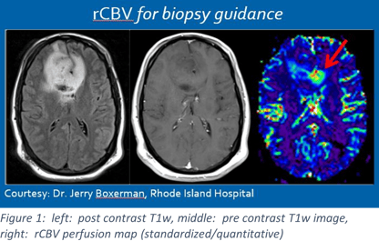 IB-Neuro-header