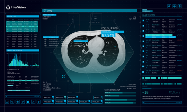 Infervision-CT-Lung-headrer-image