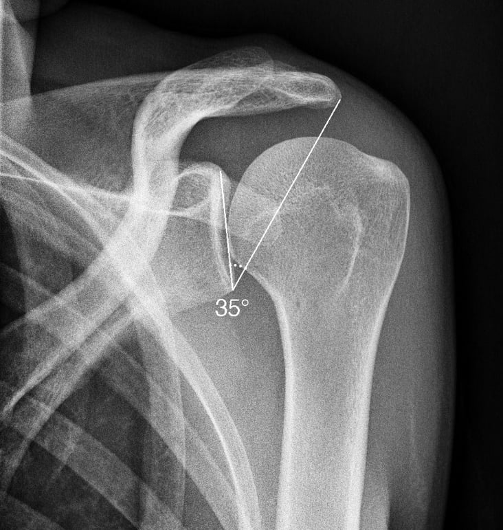 MSK Measurements | SmartXpert