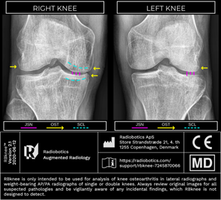 RBknee output