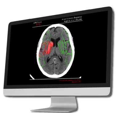 output-aspects-eu-heat-map